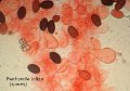 Psathyrella infida-amf2128-spores